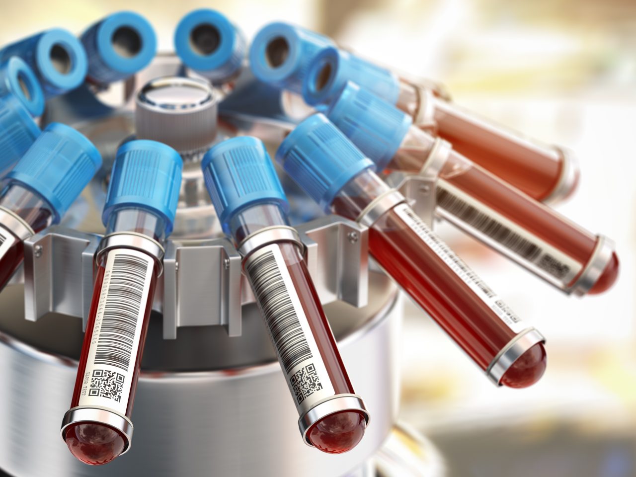 blood-test-tubes-in-centrifuge-medical-laboratory-CWURQ2F-1280x960.jpg